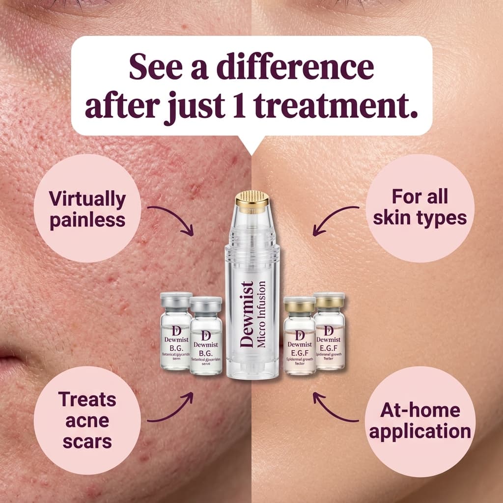 Dewmist "See a Difference After Just 1 Treatment" — Before/After Skin Split Ad
